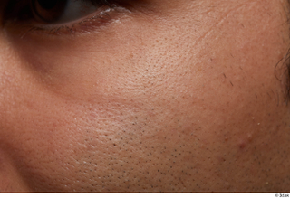 HD Face Skin Zufar Syed cheek skin pores skin texture…